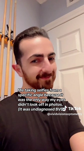 Ever find yourself only taking selfies from a specific angle because it’s the only way your eyes look ‘normal’? That was me before I found out it was actually due to binocular vision dysfunction (BVD). Follow me to learn how vision therapy and prism glasses changed everything! #bvd #binocularvisionmatters #eyestrain #selfie #prismglasses #eyepain #headaches