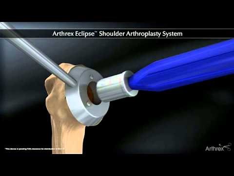 Arthrex Arthrex ECLIPSE™ Shoulder Arthroplasty System