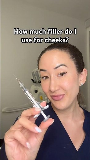 How Much Filler Is Used For Cheeks? 💉 #nonsurgicaltreatments #filler