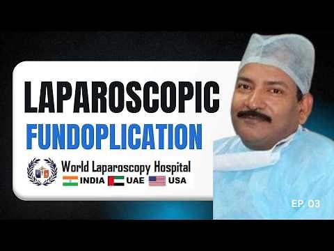 Skin-by-Skin Laparoscopic Fundoplication | Step-by-Step Anti-Reflux Surgery | Dr. R. K. Mishra