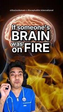 🔥🧠 If someone’s brain was on fire... would you know the signs? 🩺 Doctor explains Encephalitis