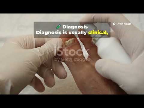 Tinea Infection Explained: Causes, Symptoms, Treatment & Prevention