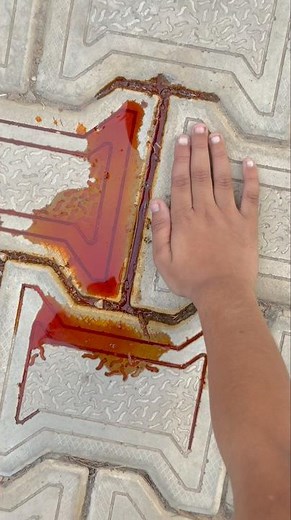 Arhan ke chot lag gayi 😭🙏#shorts