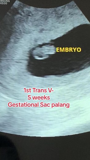 6 Weeks 6 Days Pregnant Ultrasound - Baby Development & Pregnancy Journey