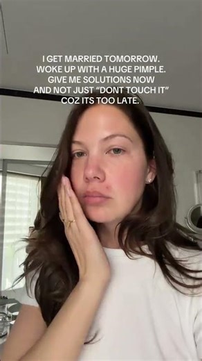 SOS! A Pimple on My Wedding Day 😭💍 #Bride #blacktie #grwm #bridesmaids