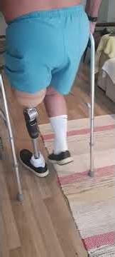 Gait training with a transfemoral prosthesis #physicaltherapy #hospital #doctor
