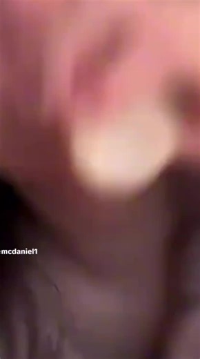 Exploring the Secrets of Yakult Under the Microscope