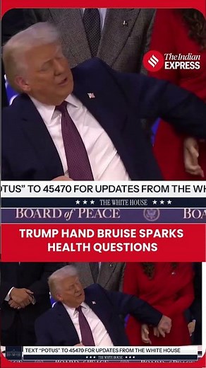 Trump Hand Bruise Sparks Health Questions During Board of Peace Signing