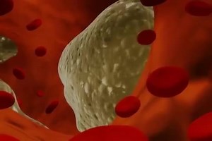 5.2K views · 103 reactions | EL CONSUMO DE ALCOHOL CAUSA MÁS...