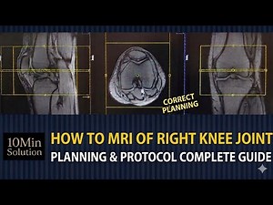 Knee MRI Protocol Step by Step — FOV, Slice Thickness, Angulation & Sequences