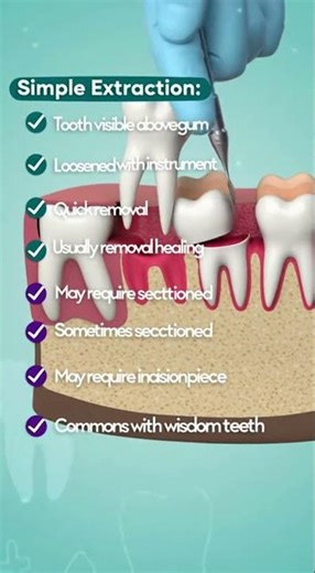Not all tooth extractions are the same.