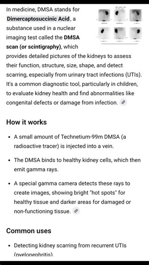 medicversity on Instagram: "DMSA scan: #dmsa #spect #DimercaptosuccinicAcid #kidneyhealth #kidney"