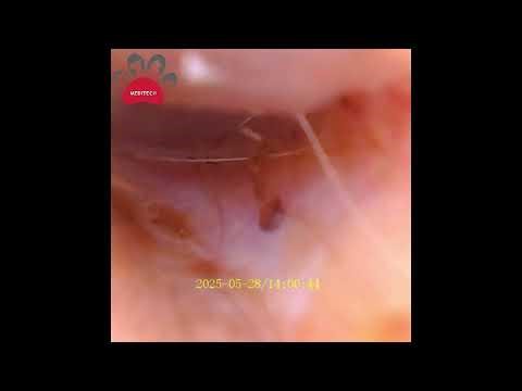 Video Otoscope Clinic Sharing-Ear canal checking for a dog