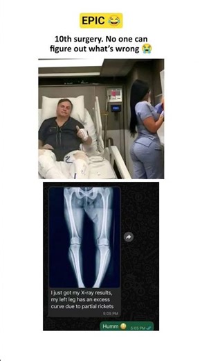 “Doctors confused… the X-ray knows the truth 😂." #funny #usa #doctor #hospital #xray #memes #viral
