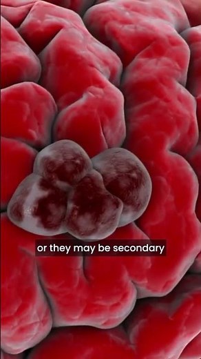 Brain Tumours Explained: Cancerous vs Non-Cancerous | World Brain Tumour Day Part 2 | Dr K Sridhar