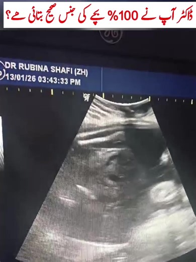 Understanding Baby Gender Prediction Methods