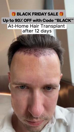 $880 → $21/Month. Limited-Time Offer. We will never do this again....