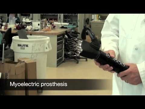 Prosthetist- Career Spotlight