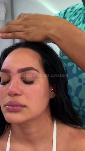 Tratamento para dor de cabeça conhecido como “Hair Popping”