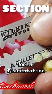 Hibiscus🌺🌺 ovary dissection axile Placentation#study #practical