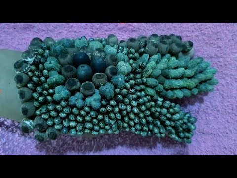 Watch This Giant Tick Wiggle Out – Shocking Yet Satisfying