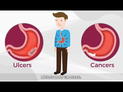 Helicobacter Pylori 101: The Bacteria That Can Cause Stomach Cancer | GUTCARE
