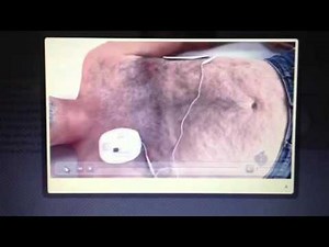 Hairy "Victim" Gets Chest Waxed by AED Pads - Funny Clip from BLS Training Video