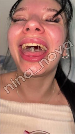 Girl hocking and spitting loogies