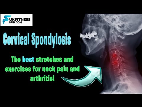 The Best Stetches and Exercises for Cervical Spondylosis and Neck Arthritis - Full Management Plan