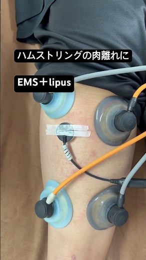 EMS + LIPUS for Hamstring Strains