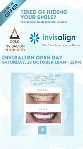 Invisalign Open Day