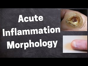 Acute Inflammation Morphology