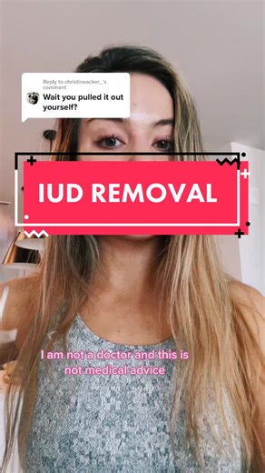 My IUD Removal Experience | Self-Performed Procedure