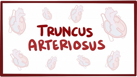 Truncus arteriosus: Video, Causes, & Meaning | Osmosis