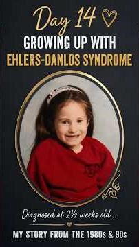Growing Up With EDS in the 1980s & 90s | Diagnosed at 2½ Weeks Old | Day 14