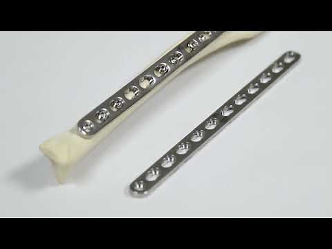 Axial Compression Plating of a Transverse Fracture with a Dynamic Locking Plate (Technique Overview)