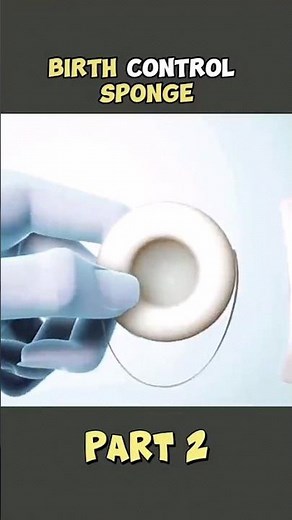Contraceptive Sponge| Part2|Birth control Options for female#viral#Shorts#shortsfeed#contraceptives