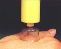 Venom extractor review