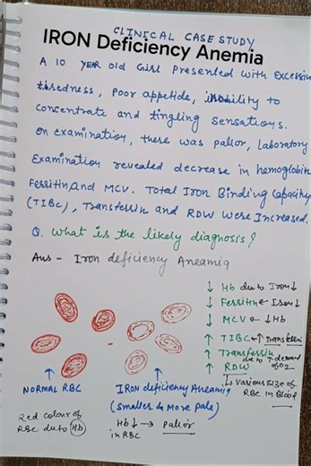 Iron Deficiency Anemia case study