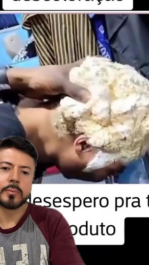 281K views · 452 reactions | Cabello decolorado directamente a la piel cabelluda error #cabello #Wow #OMG #Increible #tutorial | Carlos Bella | Facebook