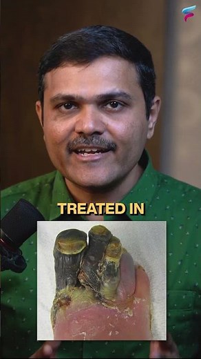 7 TIPS for Diabetic Foot Care: How to identify symptoms of Diabetes in feet? #shorts