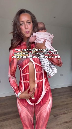 Mamma - Ab separation IS the thing that's holding your recovery back