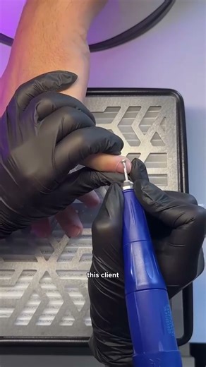 No-Cut Cuticle Removal for Sensitive Skin