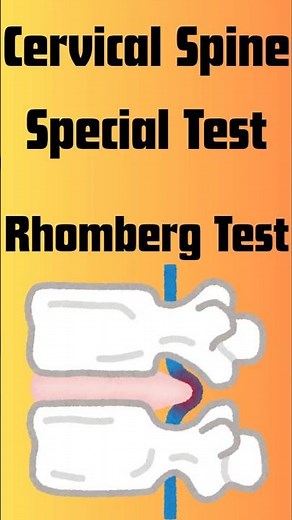 Romberg Test Explained | Positive Sign, Sensory Ataxia & Clinical Significance #shorts