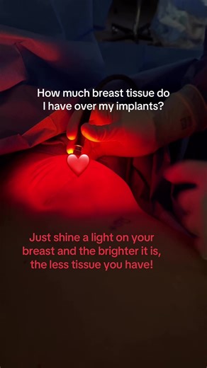 ✨ How much breast tissue do you really have over your implants? ✨ Here’s an easy at-home trick 👇💡 Try shining an LED light, your iPhone flashlight, or any small light directly on your breast. If the light transilluminates brightly through the skin and you can see it spreading across the breast, it often means you have less natural breast tissue over your implant. 💡➡️🌸 This can happen after: • Larger breast augmentations ⬆️ • Mastectomy 💕 • Multiple revisions 🔄 Over time, the tissue can thi