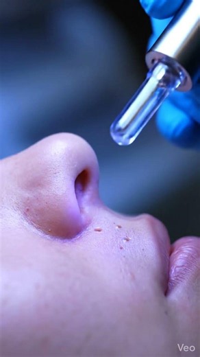 POV: The Most Satisfying Nose Pore Clean! ✨