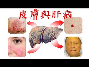皮膚15症狀,是肝有問題,保健肝5方法,柏格醫生 Dr Berg