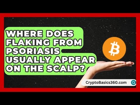 Where Does Flaking From Psoriasis Usually Appear on the Scalp? | Psoriasis Relief Guide