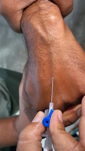 22G Blue IV Cannula Procedure technique | IV cannulation Technique | iv cannula #shorts #shortsfeed