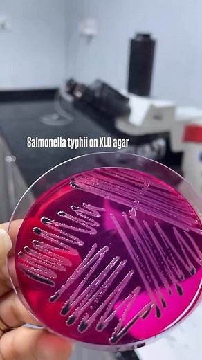 Salmonella typhi on xld agar 😍 #microbiology #microbiologist #microbiologylab #explorepage #bacteriology #microbe #science #molecularbiology #kesfet #virology #pcr #cell #culture #media #molecular #lifescience #knowledge #know #fact #mikrobiyoloji #bacteria #bakteri #microbiologia #lab #laboratory #phd #phdstudent #fyp #viral #reel | Medical Microbiologist